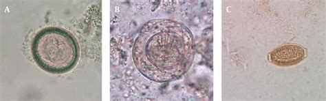 alcorfix|Ova and Parasite Exam, Fecal (Immunocompromised or Travel。